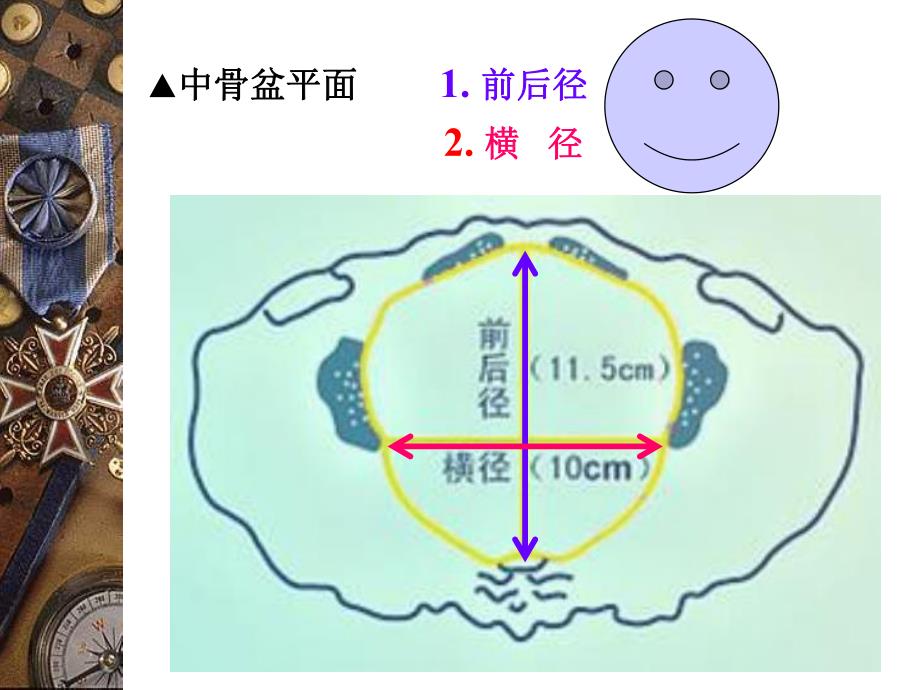 妇产科骨盆内、外测量.ppt_第3页