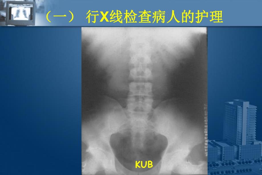 第十九章泌尿系统泌尿系常用的诊疗操作.ppt_第3页