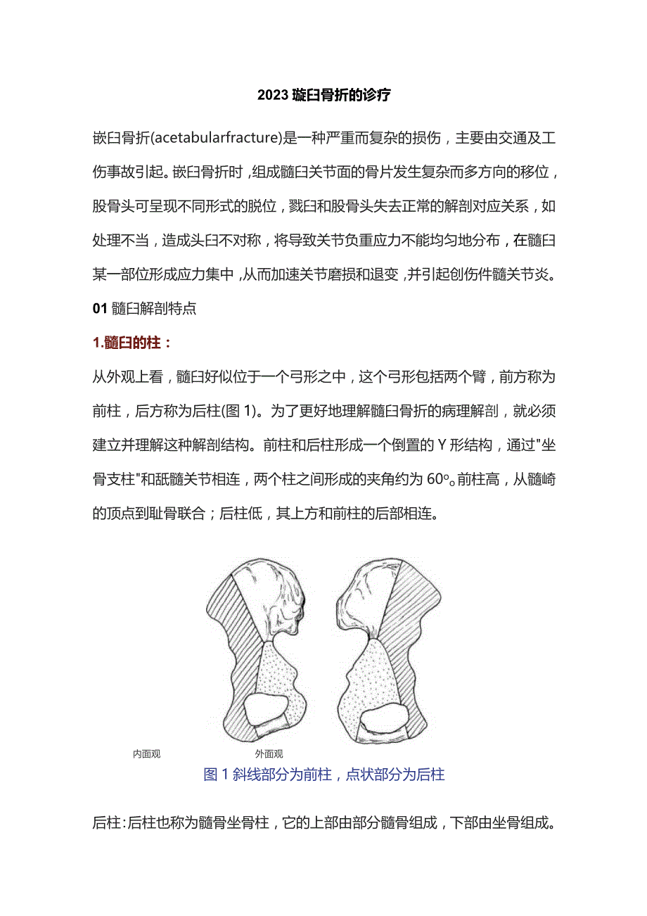 2023髋臼骨折的诊疗.docx_第1页