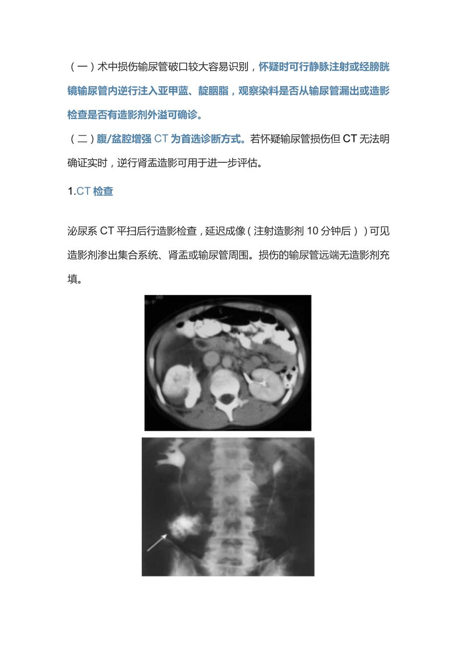 2023医源性输尿管损伤诊断及处理策略.docx_第3页