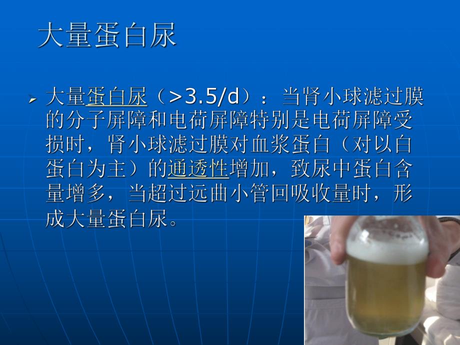 肾病综合征的健康宣教22.ppt_第3页