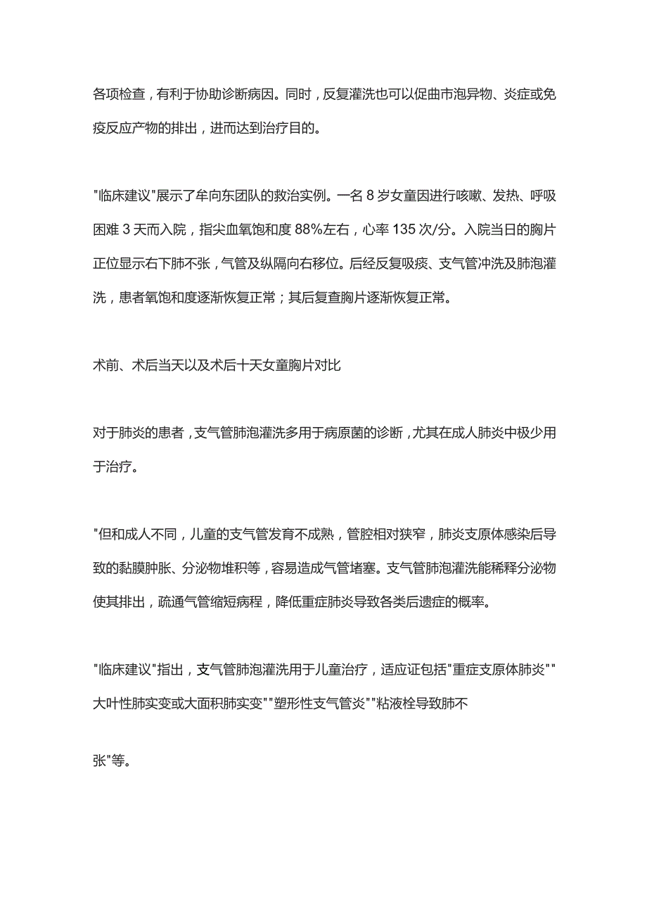 2023儿童重症支原体肺诊治清华长庚医院“临床建议”.docx_第2页