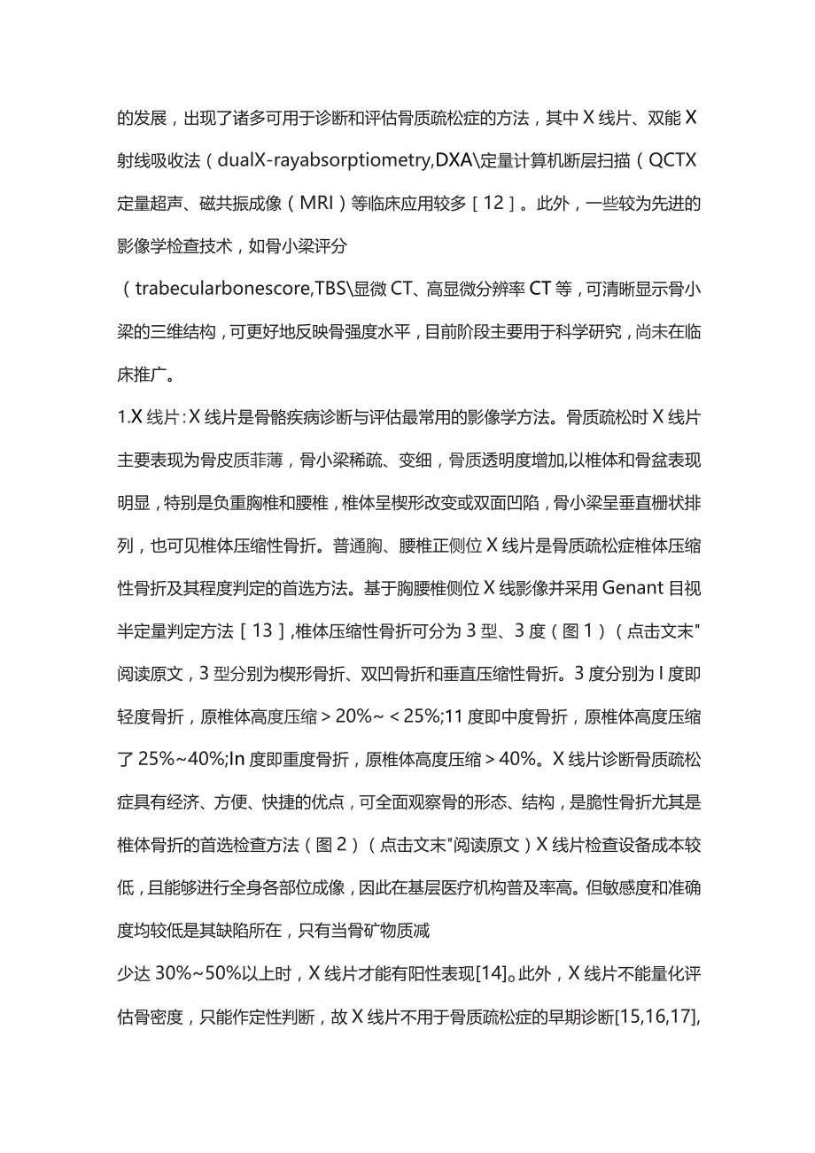 2023原发性骨质疏松症的影像学检查与诊断.docx_第3页