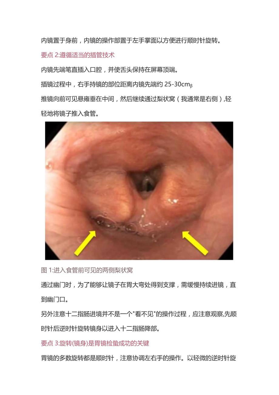 2023胃镜的内镜操作技巧.docx_第2页