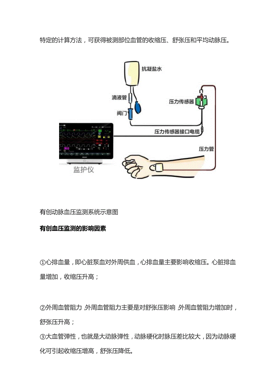 2023有创血压监测总结.docx_第3页