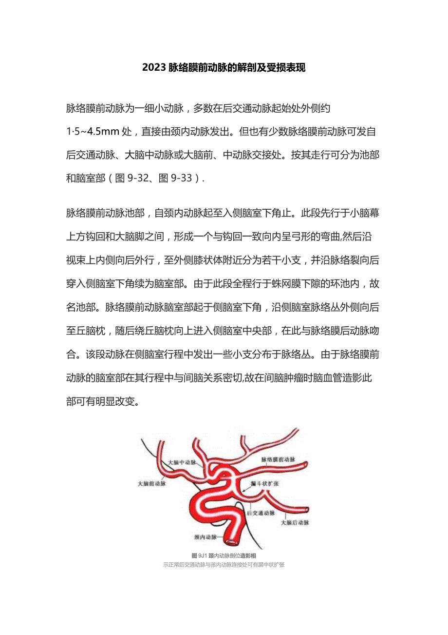 2023脉络膜前动脉的解剖及受损表现.docx_第1页