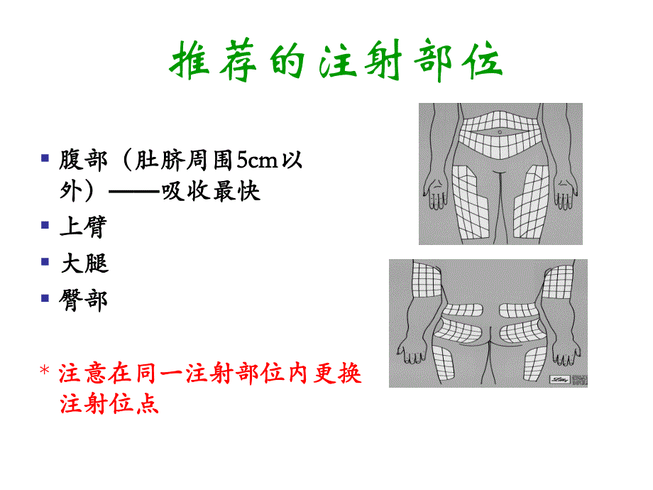 胰岛素注射及注意事项.ppt_第3页