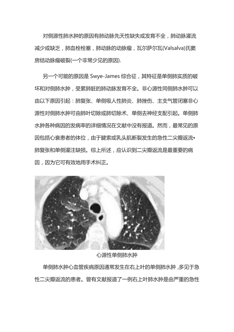 2023心衰导致单侧肺水肿的病因分析.docx_第2页