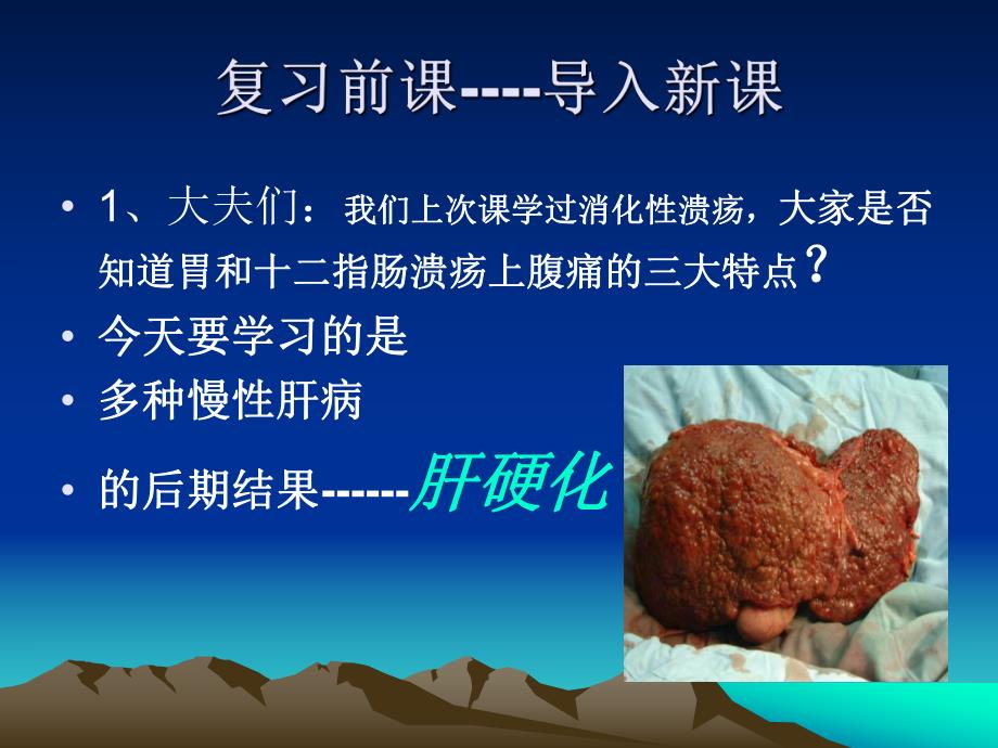 肝硬化完整.ppt_第2页