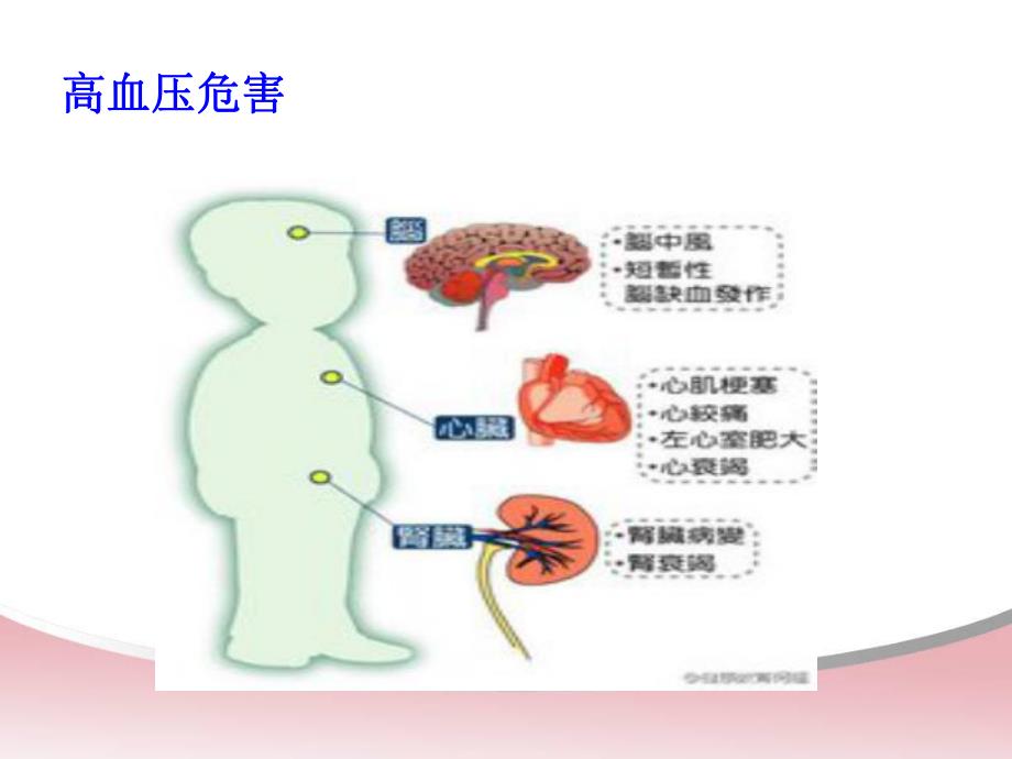 高血压饮食指导.ppt_第3页