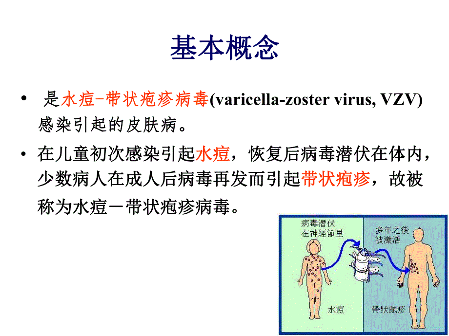 带状疱疹的护理.ppt_第3页