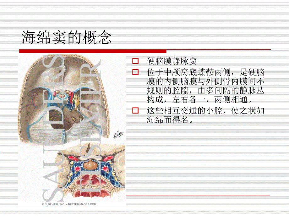 海绵窦综合征.ppt_第3页