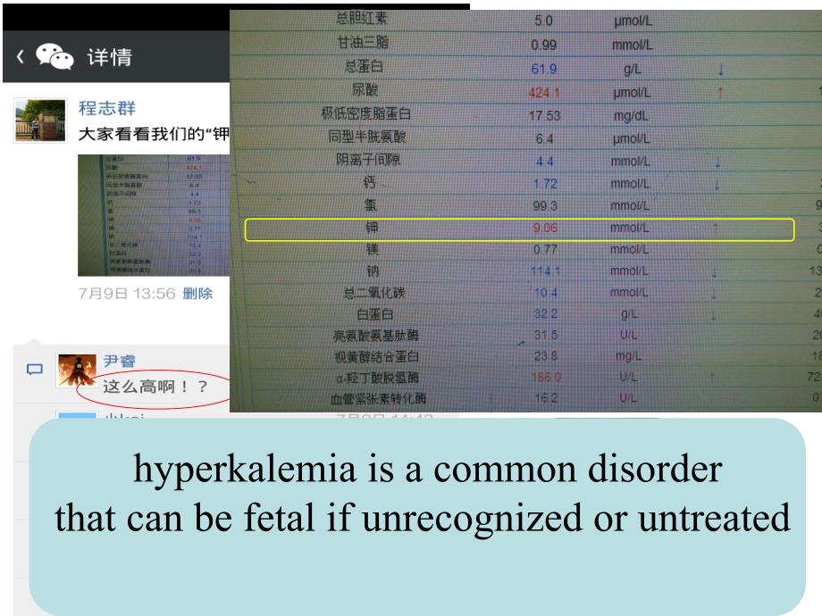 高钾血症(中心医院肾内科).ppt_第2页