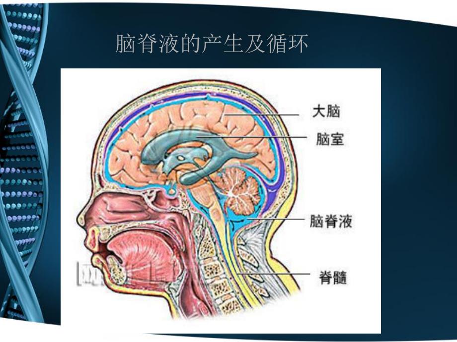 脑积水治疗和护理.ppt_第3页