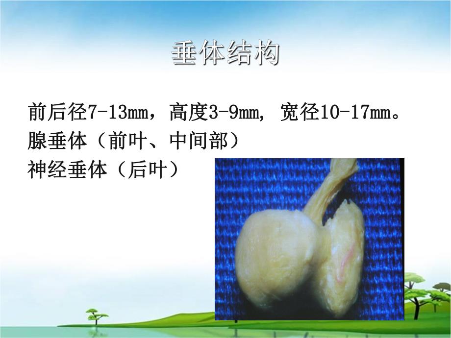 垂体危象.ppt_第3页