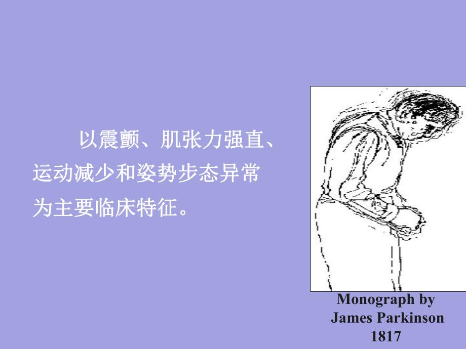 帕金森病.ppt_第3页