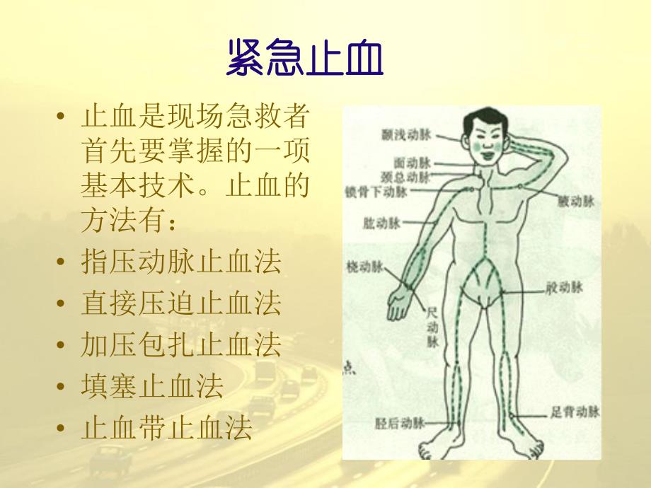 外伤止血包扎固定术.ppt_第3页