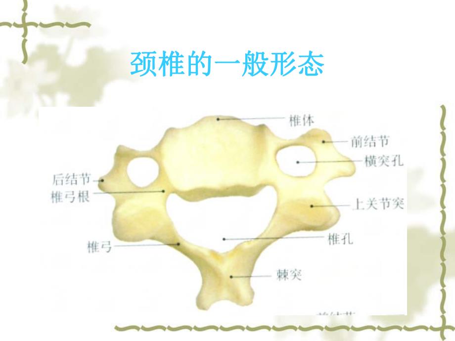 颈椎病的X线征象与临床.ppt_第3页