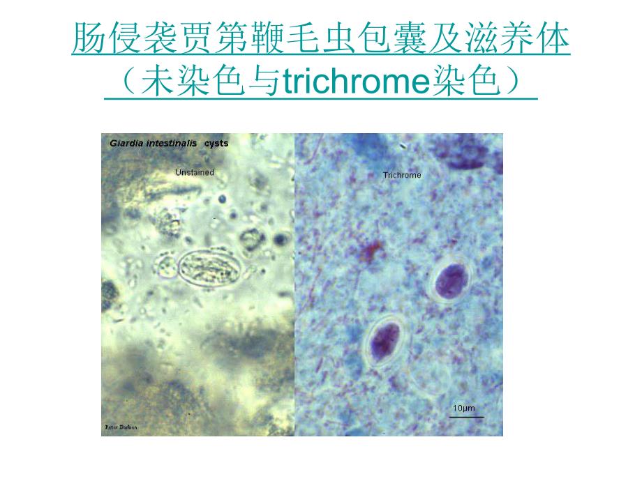 寄生虫切片.ppt_第1页