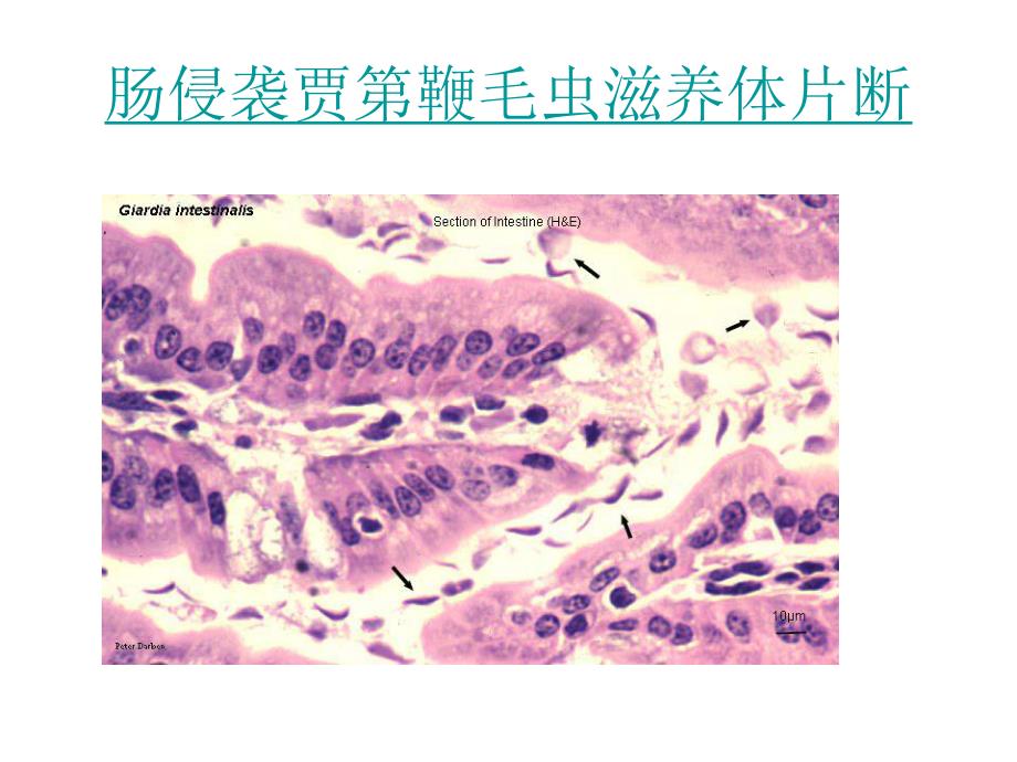 寄生虫切片.ppt_第3页