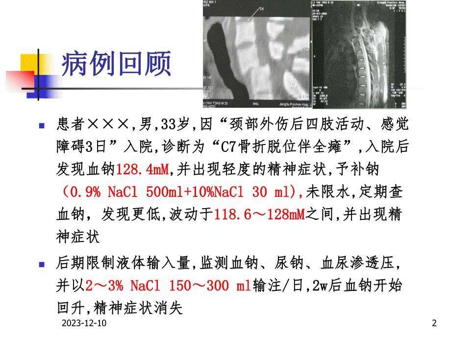 颈脊髓损伤后低钠血症.ppt_第2页