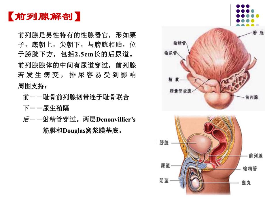 前列腺增生.ppt_第3页