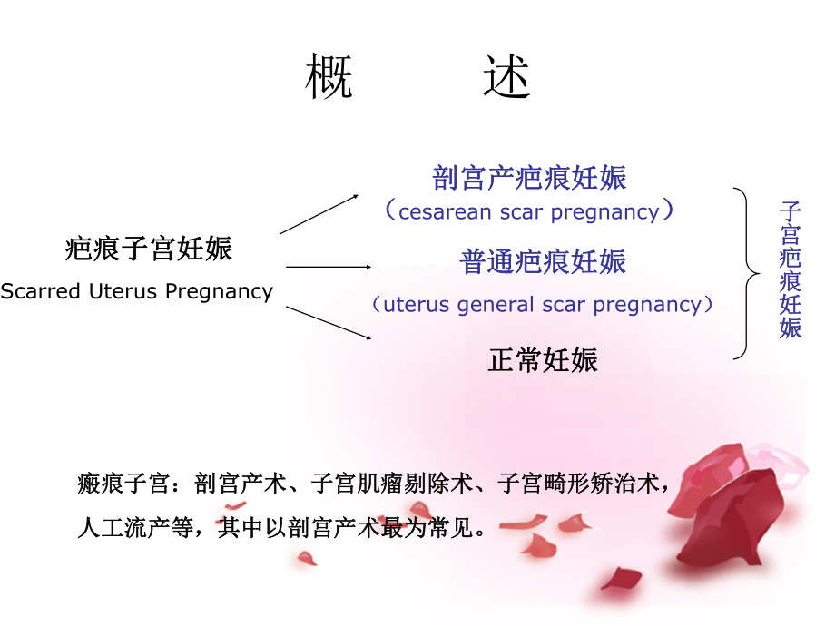 3.疤痕妊娠的影像学诊断姚穗.ppt_第2页