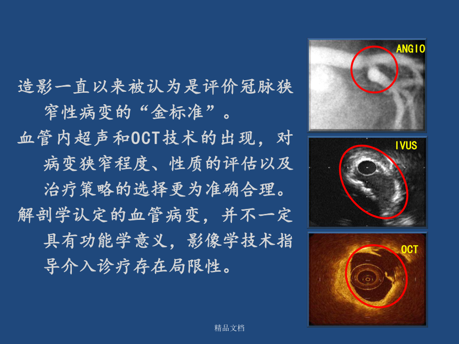 FFR临床应用.ppt_第2页