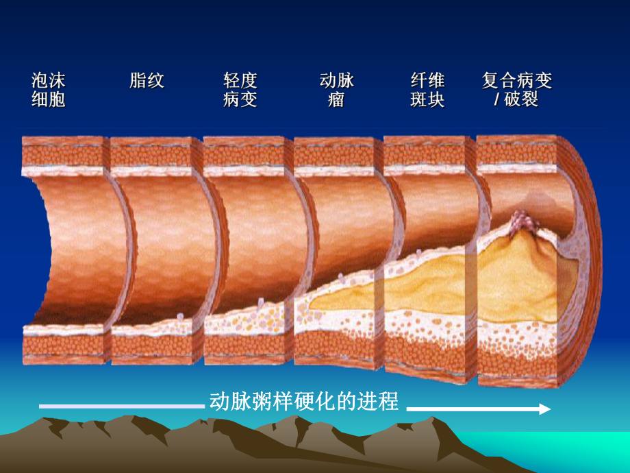 冠心病诊断与治疗指南.ppt_第3页