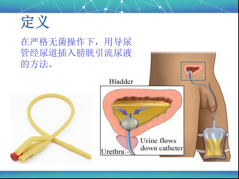 留置尿管的健康教育.ppt_第2页