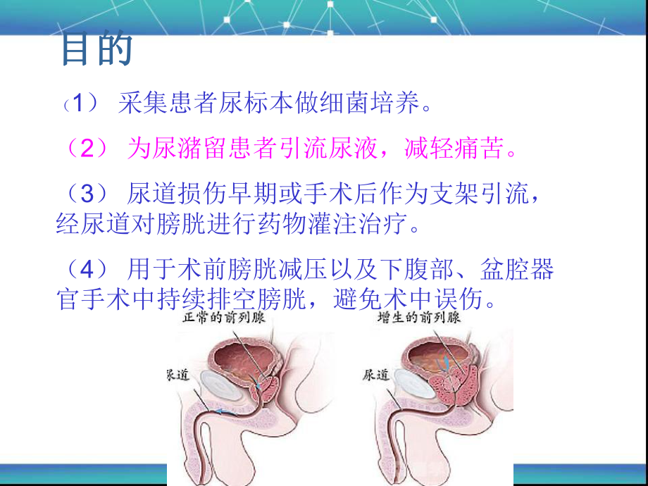 留置尿管的健康教育.ppt_第3页