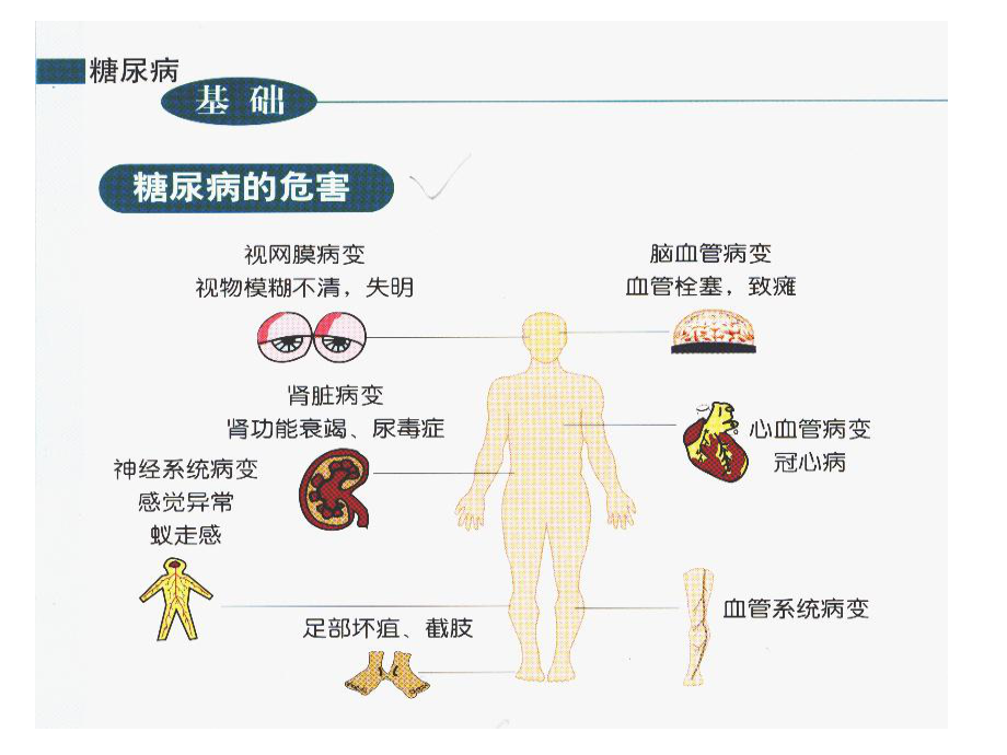 糖尿病与脑梗塞.ppt_第2页