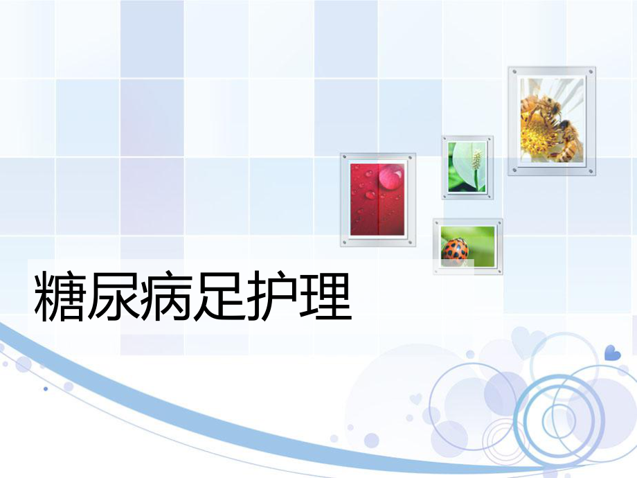 糖尿病足的护理PPT.ppt_第1页