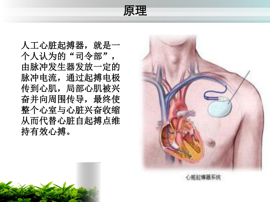 起搏器植入术的健康教育.ppt_第3页