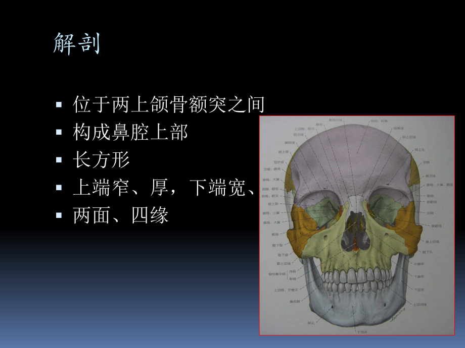 鼻骨骨折影像学诊断与鉴别(精品).ppt_第2页