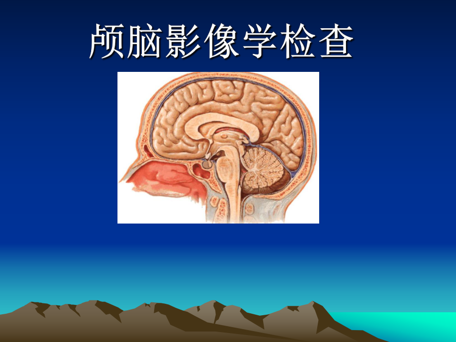 颅脑影像学检查.ppt_第1页