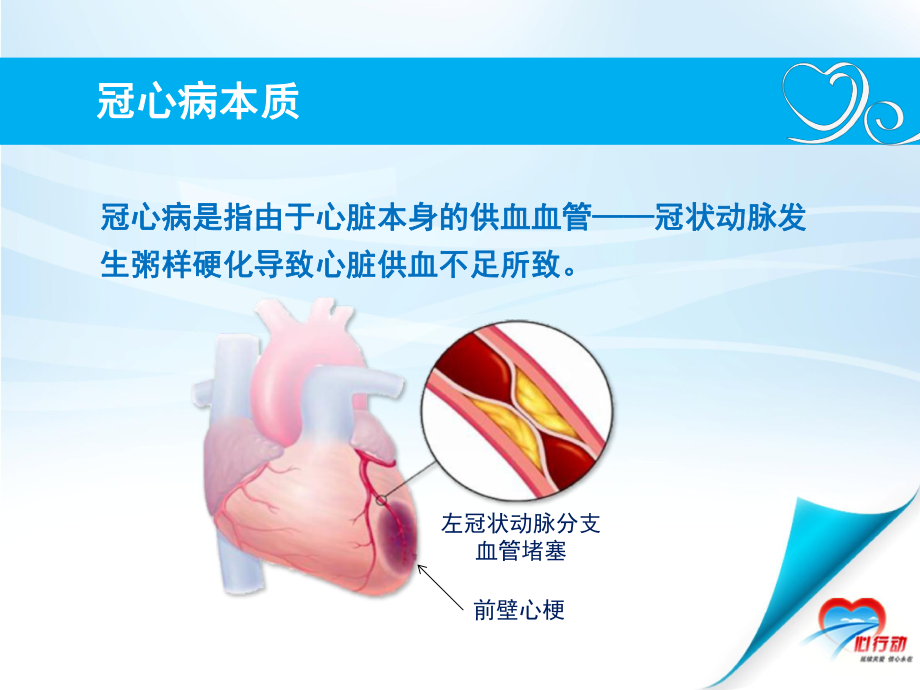 冠心病健康教育(8).ppt_第3页