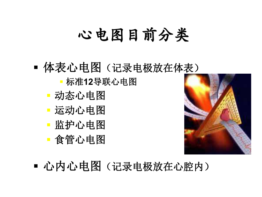 临床心电图分析.ppt_第2页