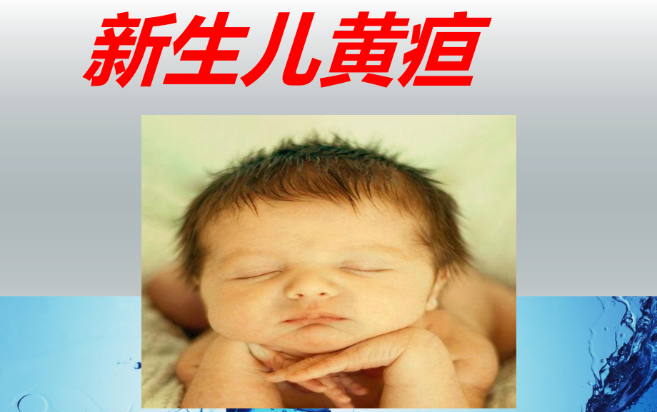 新生儿黄疸PPT.ppt_第1页