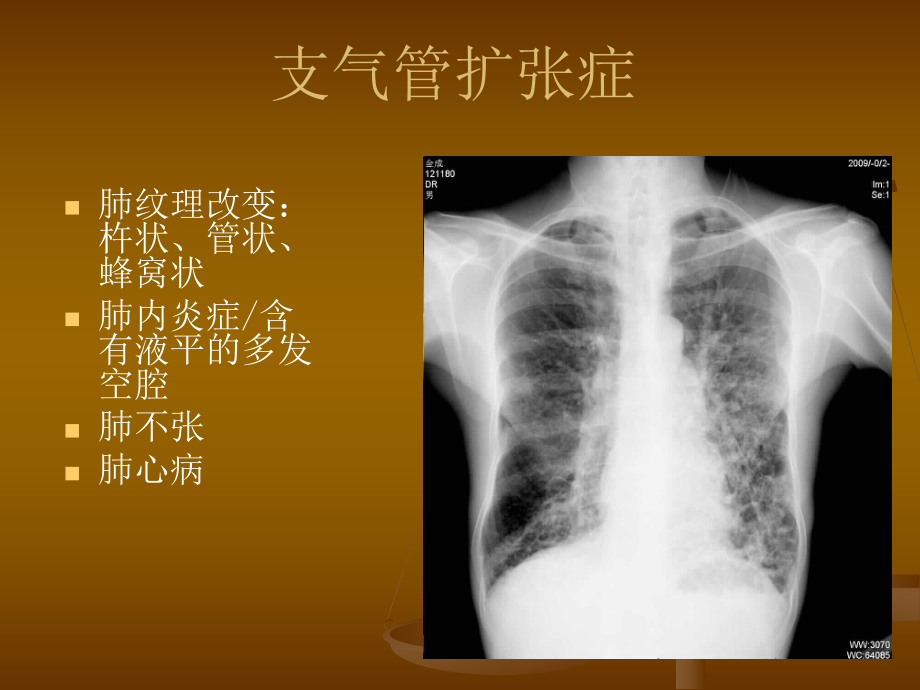 【医学课件】呼吸系统实习PPT.ppt_第3页