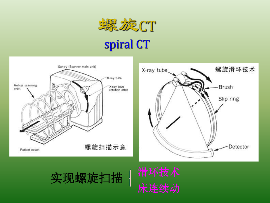 医学影像读片指南PPT课件.ppt_第3页