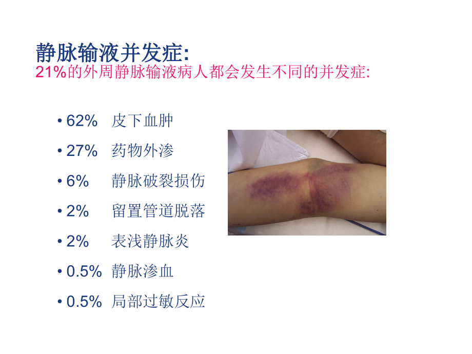 医学课件静脉炎的预防和处理.ppt_第2页