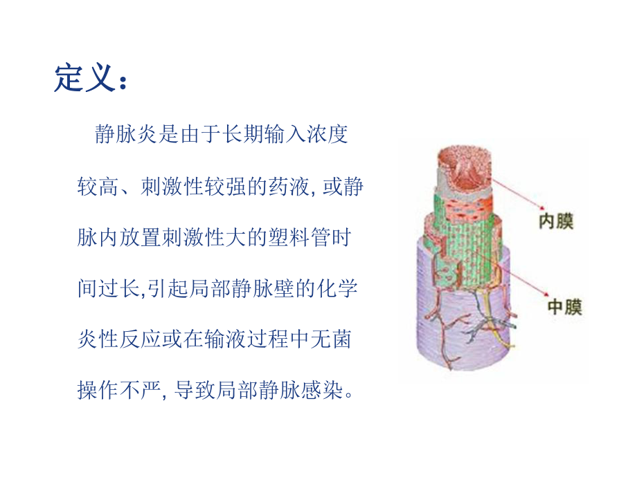 医学课件静脉炎的预防和处理.ppt_第3页