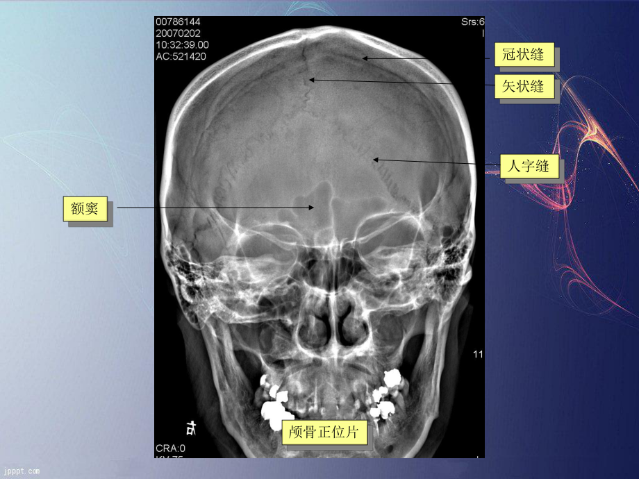 医学影像诊断PPT课件：中枢神经系统医学影像学.ppt_第2页