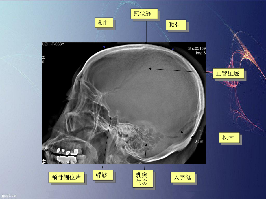 医学影像诊断PPT课件：中枢神经系统医学影像学.ppt_第3页