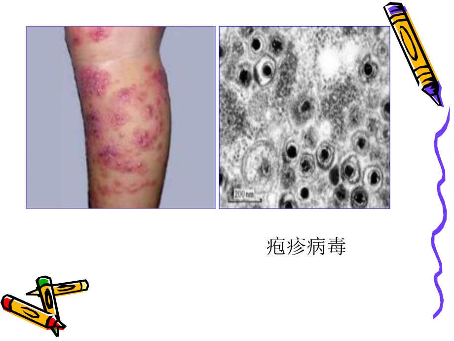 微生物的危害.ppt_第3页