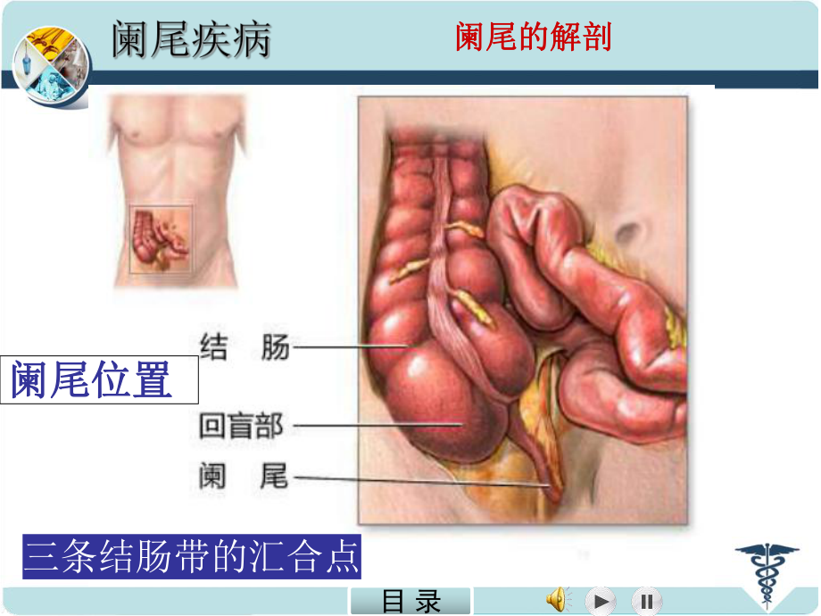 急性阑尾炎精品医学PPT课件.ppt_第2页