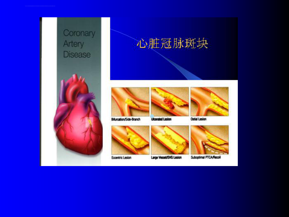 护理医学幻灯片ppt课件.ppt_第3页