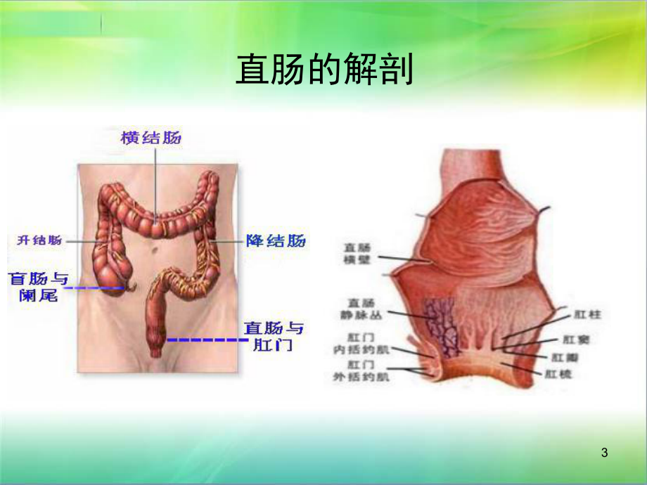 直肠癌病例讨论PPT医学课件.ppt_第3页