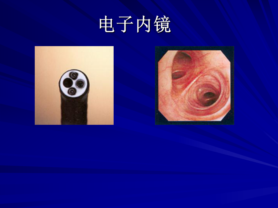 生物医学测量与仪器课件9.ppt_第2页